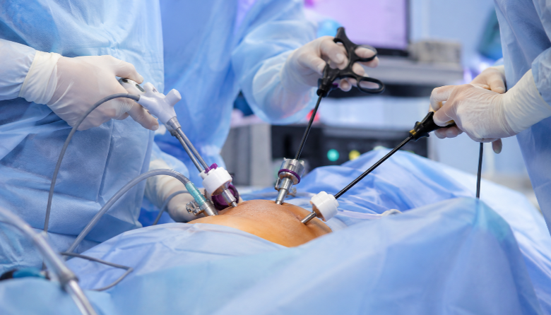 Gynaecology Surgeries Made Easier: Benefits of Laparoscopic Techniques